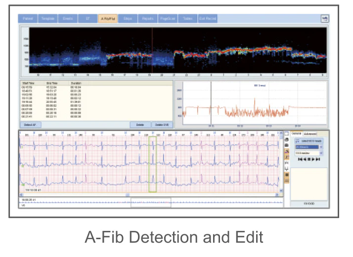 CardioSW-Holter análisis de A-Fib, detección y edición de arritmias