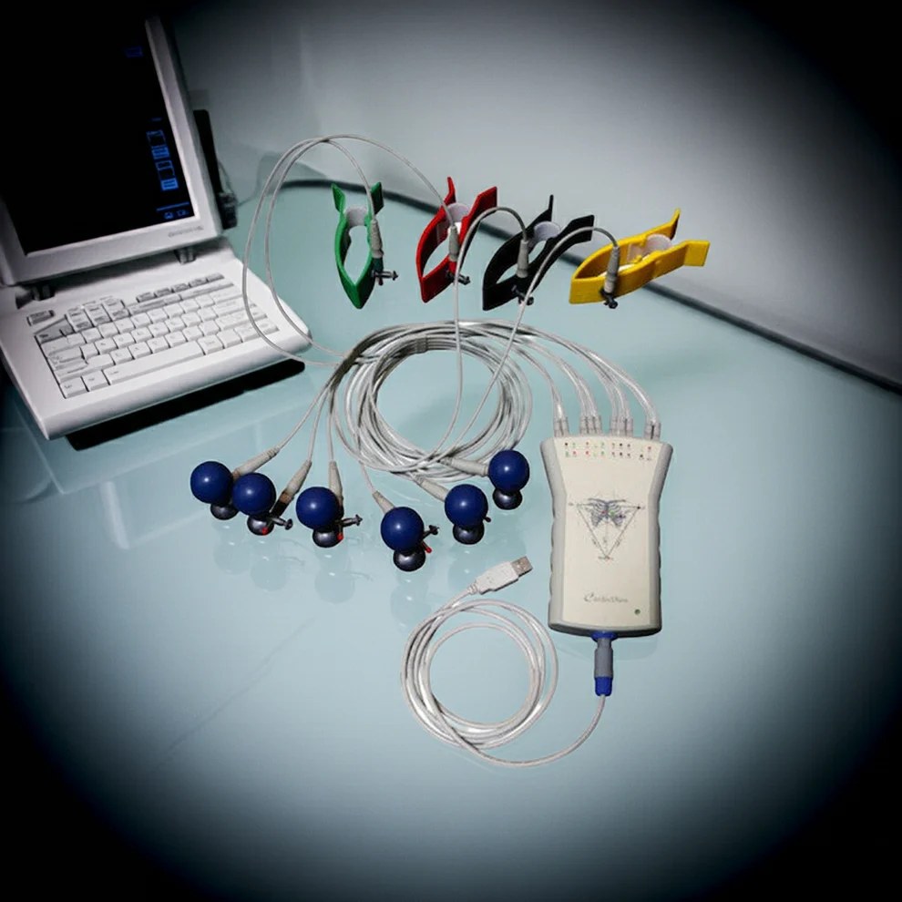 Electrocardiógrafo CV200 conectado a laptop, con pinzas de extremidades y electrodos precordiales