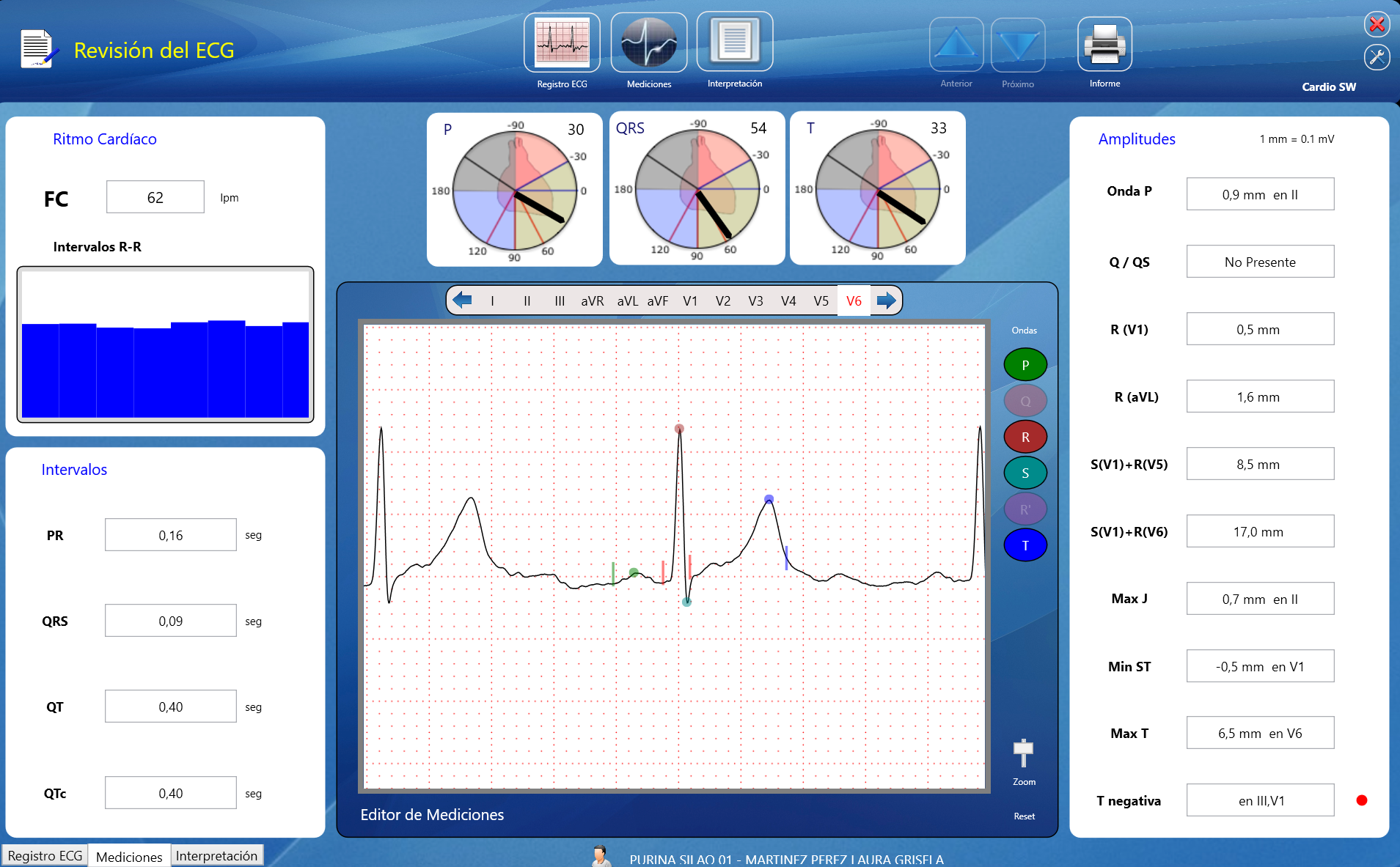 CardioSW-RestECG pantalla de revisión de ECG con mediciones y ejes cardíacos